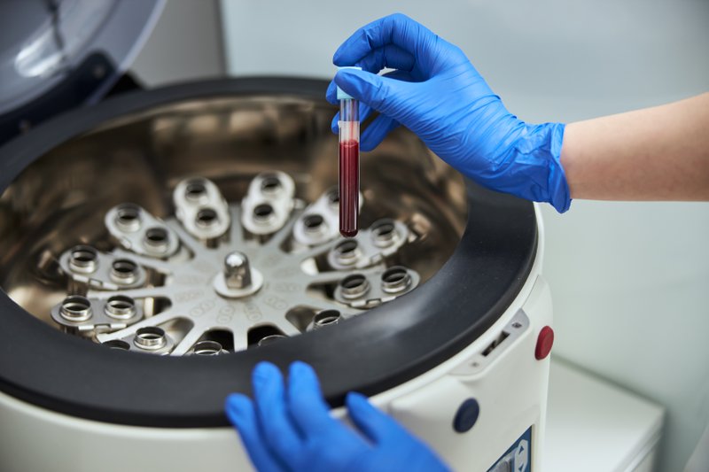  What Are Platelets and Platelet-Rich Plasma?